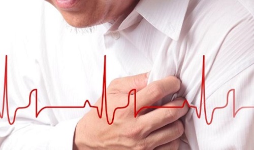 thieu mau co tim Bài thuốc dân gian phòng ngừa bệnh thiếu máu cơ tim hiệu quả