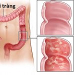 viem-dai-trang