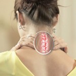 chua-benh-thoai-hoa-dot-song-co